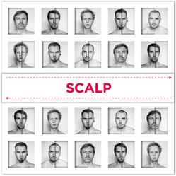 SCALP / VICTIMS OF HATE